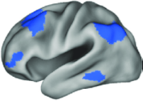 fluid intelligence frontoparietal network